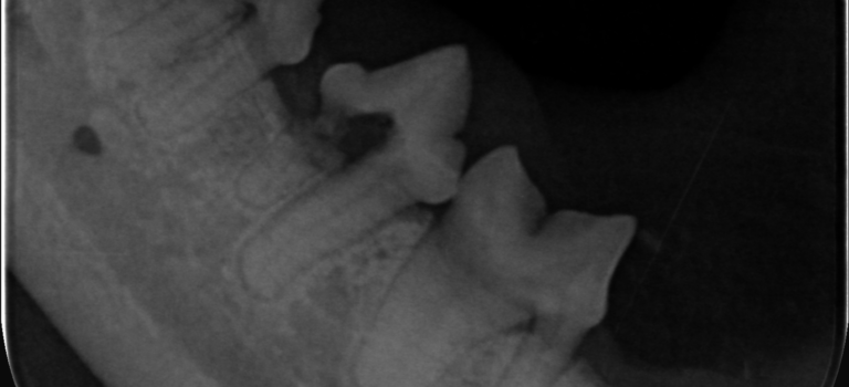 Dentale Röntgenuntersuchung Dentale Röntgenuntersuchung